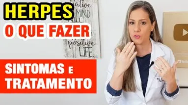HERPES - O QUE FAZER e o que NÃO FAZER - Causas, Tratamentos e Sintomas