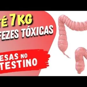 Até 7 KG DE FEZES Tóxicas PRESAS no INTESTINO? Veja Isso!