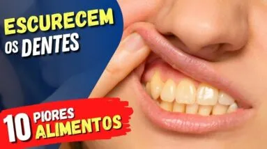 10 ALIMENTOS que ESCURECEM A COR DOS DENTES e Como EVITAR