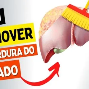 Como REVERTER a GORDURA NO FÍGADO - Rápido e NATURALMENTE!