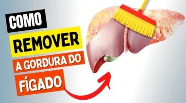 Como REVERTER a GORDURA NO FÍGADO - Rápido e NATURALMENTE!