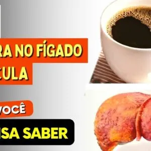 CAFÉ, GORDURA NO FÍGADO e CÁLCULOS BILIARES -  O que você PRECISA SABER!