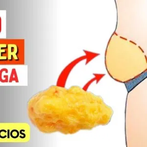 Como PERDER BARRIGA SEM FAZER EXERCÍCIOS (o mais rápido possível)