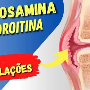 GLUCOSAMINA E CONDROITINA para Articulações - Como Funciona, Para Que Serve e Cuidados