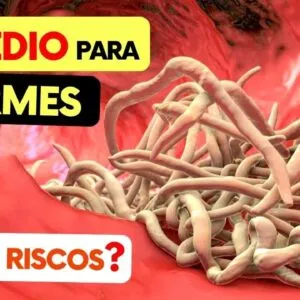 Remédio para VERMES - Todos Adultos Devem Tomar! (Qual? Que frequência? Riscos?)