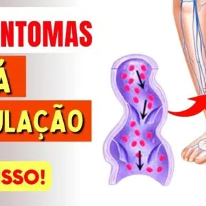 10 SINTOMAS que sua CIRCULAÇÃO PODE NÃO ESTAR BEM (sinais de má circulação)