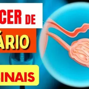 10 SINAIS de Alerta para CÂNCER DE OVÁRIO que Toda Mulher Deveria Saber
