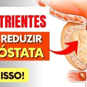 REDUZIR A PRÓSTATA - Os 3 nutrientes MAIS IMPORTANTES