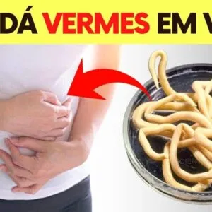 ISSO DÁ VERMES EM VOCÊ! Não faça essas coisas! Cuidados, Sinais e Dicas Importantes