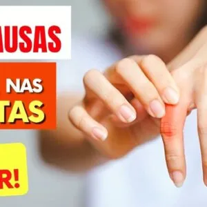 10 Causas de DOR NAS JUNTAS e O QUE FAZER