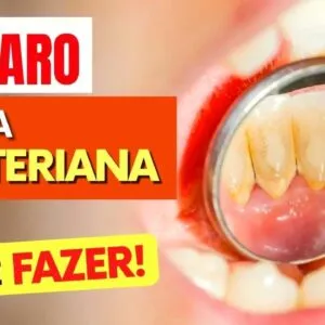 Você tem TÁRTARO (Placa bacteriana)? Vai ADORAR ISSO! (Faça DESSA FORMA)