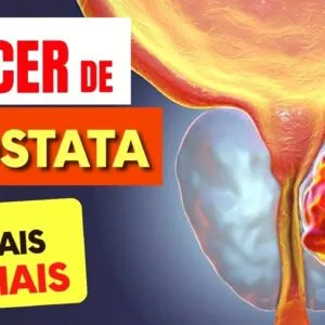 5 SINAIS de Alerta para CÂNCER de PRÓSTATA que Todos Deveriam Saber
