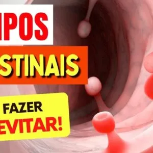Como Evitar PÓLIPOS INTESTINAIS - O Que Você PRECISA SABER!