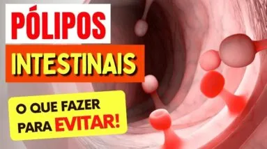 Como Evitar PÓLIPOS INTESTINAIS - O Que Você PRECISA SABER!