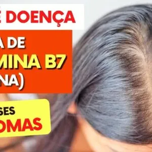 Não é Doença, É FALTA DE VITAMINA B7 (Biotina)! Você está SENTINDO ISSO?