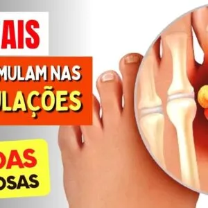 5 Bebidas que Causam ACUMULO DOLOROSO de CRISTAIS nas ARTICULAÇÕES