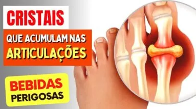 5 Bebidas que Causam ACUMULO DOLOROSO de CRISTAIS nas ARTICULAÇÕES