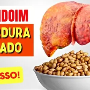 AMENDOIM e GORDURA NO FÍGADO -  O que você PRECISA SABER!
