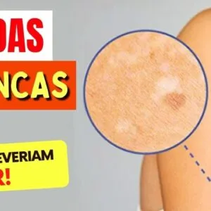 SARDAS BRANCAS - Coisas que TODO MUNDO DEVERIA SABER!