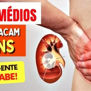 5 Remédios que ATACAM OS RINS - Todos DEVERIAM SABER!