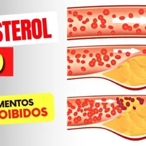 10 Alimentos PROIBIDOS para COLESTEROL ALTO (e Como BAIXAR o COLESTEROL RAPIDO)
