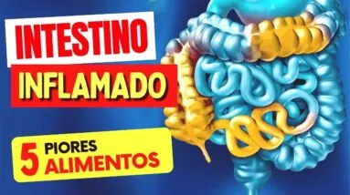 5 ALIMENTOS que MAIS INFLAMAM SEU INTESTINO! (Troque por Esses!)