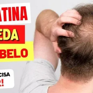 CREATINA e QUEDA DE CABELO - O que você PRECISA SABER!