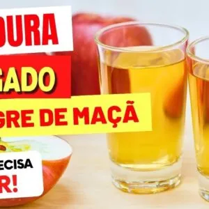 VINAGRE DE MAÇÃ e GORDURA NO FÍGADO -  O que você PRECISA SABER!