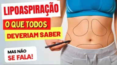 LIPOASPIRAÇÃO - O que TODOS DEVERIAM SABER! (mas não se fala)