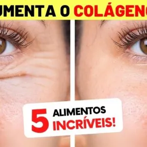 ESTIMULAÇÃO DO COLÁGENO - 5 Alimentos CONTRA RUGAS E FLACIDEZ (Use Assim!)