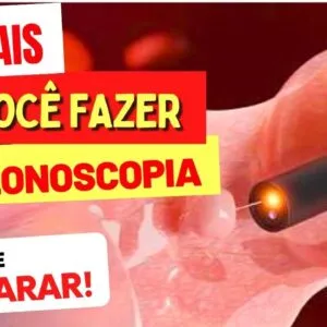 COLONOSCOPIA - 7 SINAIS que você PRECISA FAZER e Como se PREPARAR