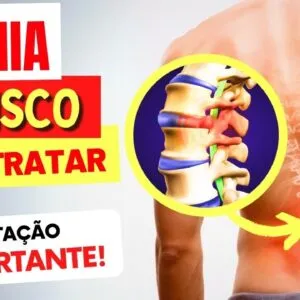 HÉRNIA DE DISCO - SINTOMAS, Como TRATAR e ALIMENTOS IMPORTANTES