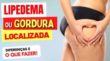 LIPEDEMA ou GORDURA LOCALIZADA - Diferenças e O QUE FAZER!