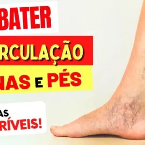 6 FRUTAS para COMBATER MÁ CIRCULAÇÃO NAS PERNAS E PÉS (e COMO USAR)