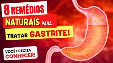 8 REMÉDIOS NATURAIS para TRATAR a GASTRITE