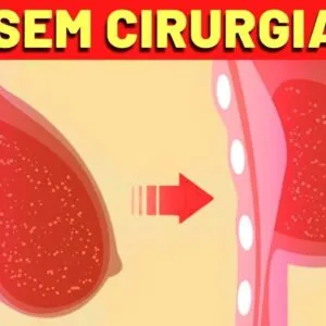 LEVANTAR OS SEIOS SEM CIRURGIA? Veja ISSO!
