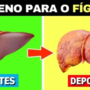 6 COISAS que ACABAM COM SEU FÍGADO e são MUITO RUINS para sua SAÚDE!