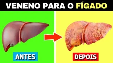 6 COISAS que ACABAM COM SEU FÍGADO e são MUITO RUINS para sua SAÚDE!