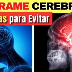 10 Dicas IMPORTANTES para evitar o DERRAME CEREBRAL! Como prevenir o AVC?