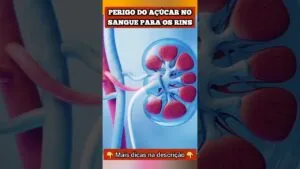 PERIGO do AÇÚCAR NO SANGUE para os RINS