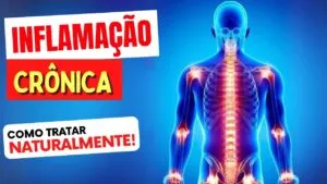 INFLAMAÇÃO CRÔNICA - O QUE É e Como TRATAR NATURALMENTE