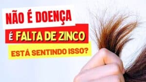 Não é Doença, É FALTA DE ZINCO! Você está SENTINDO ISSO?