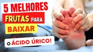 5 Melhores FRUTAS para BAIXAR ÁCIDO ÚRICO