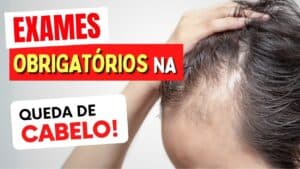 EXAMES OBRIGATÓRIOS na QUEDA DE CABELO
