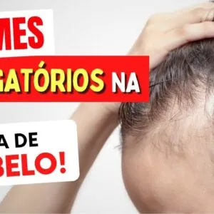 EXAMES OBRIGATÓRIOS na QUEDA DE CABELO
