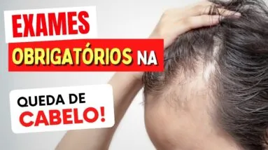 EXAMES OBRIGATÓRIOS na QUEDA DE CABELO