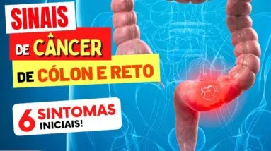 6 SINTOMAS INICIAIS de CÂNCER de CÓLON e RETO que você NÃO PODE IGNORAR!