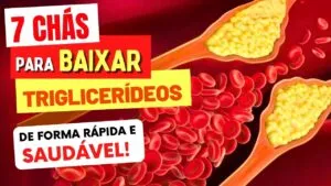 7 CHÁS para BAIXAR TRIGLICERÍDEOS ALTO! Os Melhores e Com Usar!