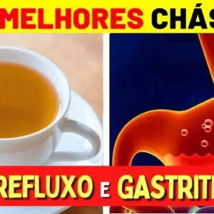 5 Melhores CHÁS para GASTRITE e REFLUXO - Benefícios, Como Preparar e Como Tomar