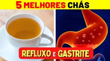 5 Melhores CHÁS para GASTRITE e REFLUXO - Benefícios, Como Preparar e Como Tomar